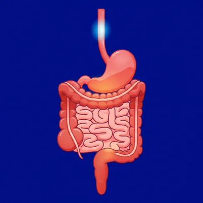 Illustration esophageal