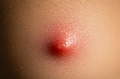 Illustration sting - Image 1