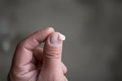 Illustration flapper - Image 1