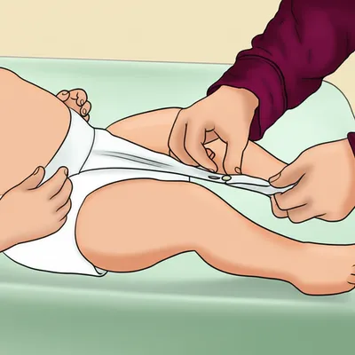 Illustration diapering - Image 1