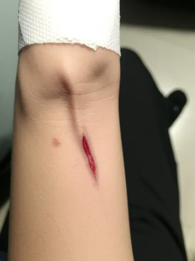 Illustration wounding - Image 1