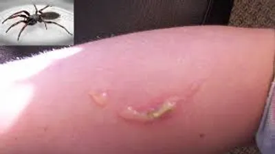 Illustration biting - Image 2