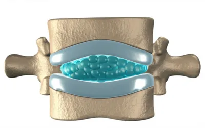 Illustration disc - Image 1