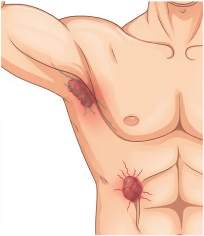 Illustration bubo - Image 1