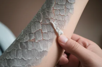 Illustration scales - Image 1