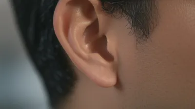 Illustration lugs - Image 1