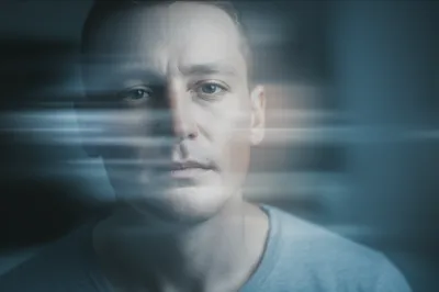 Illustration burns - Image 1