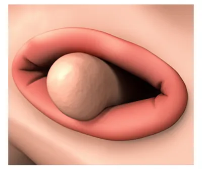 Illustration forking - Image 1