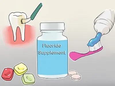 Illustration fluoride - Image 2