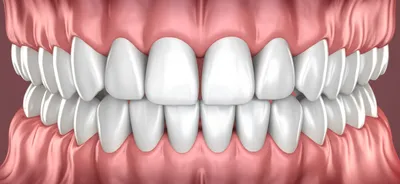 Illustration ivory - Image 1