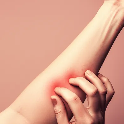 Illustration itching - Image 1