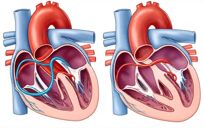 Illustration bypass - Image 1