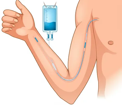 Illustration tunneled - Image 1