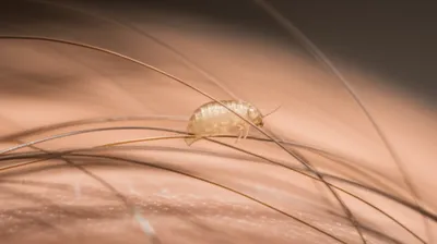 Illustration nit - Image 1