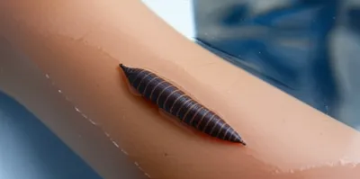 Illustration leeches - Image 1