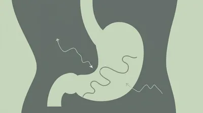 Illustration upset - Image 1