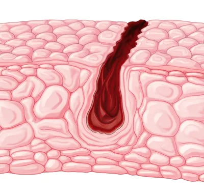 Illustration sinus - Image 1