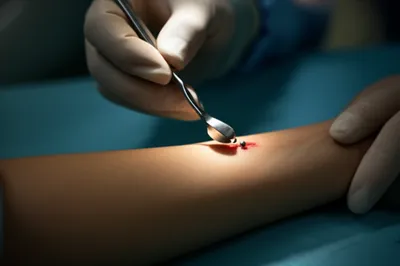 Hình ảnh minh họa scoop - Ảnh 1