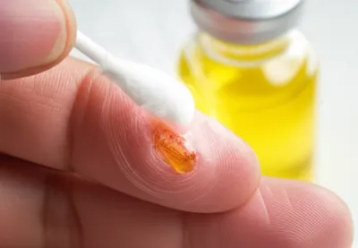 Illustration iodine - Image 1