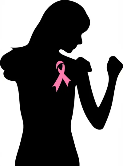 Illustration mastectomy - Image 2