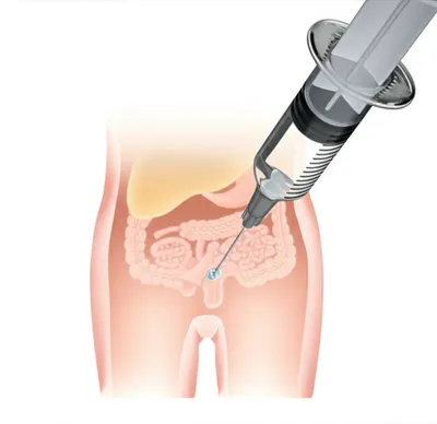 Illustration douches - Image 1