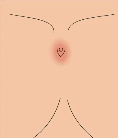 Illustration nips - Image 1