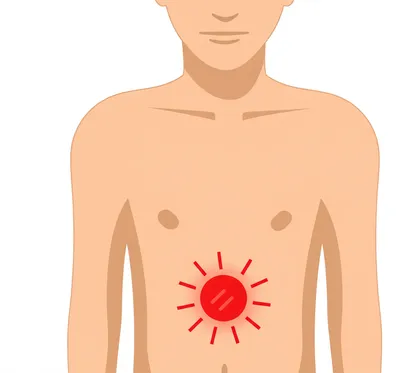 Illustration allergy - Image 1