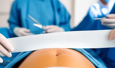 Illustration rollers - Image 1