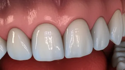 Illustration gum - Image 1