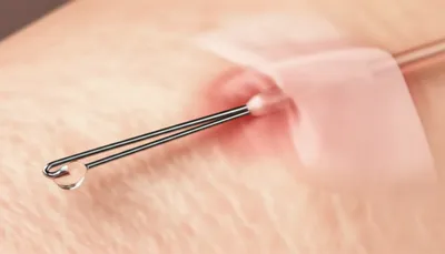 Illustration infiltrating - Image 1