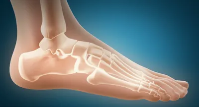 Illustration tarsal - Image 1