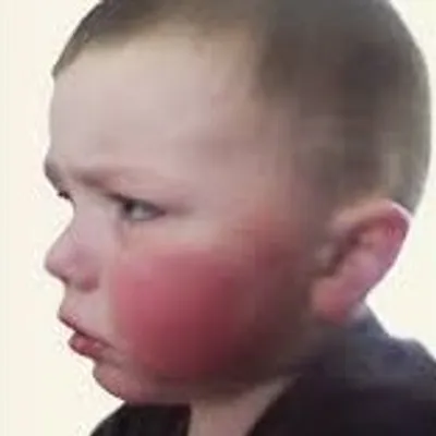 Illustration flushed - Image 2