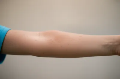 Illustration macules - Image 1