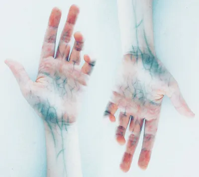 Illustration veins - Image 2