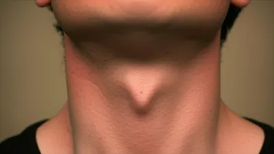 Illustration breaking - Image 1