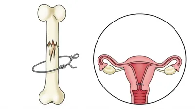 Illustration cerclage - Image 1