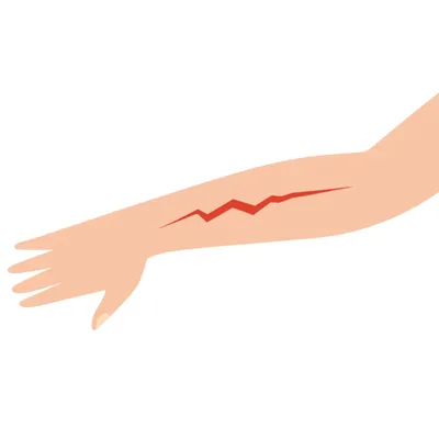 Illustration wound - Image 1