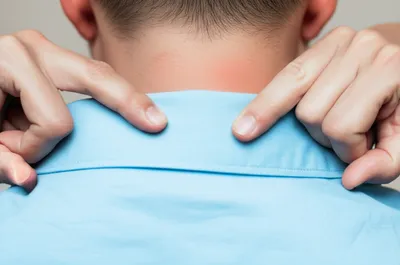 Hình ảnh minh họa irritation