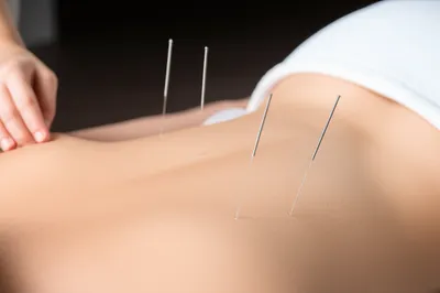 Illustration acupuncture - Image 1