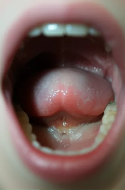 Illustration uvular - Image 1