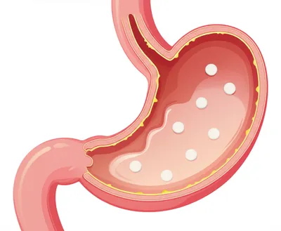 Illustration antacid