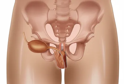 Illustration prostate - Image 1