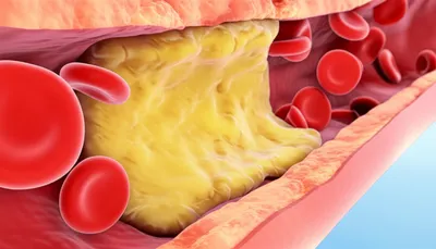 Illustration plaque - Image 1