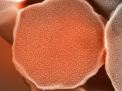 Illustration sintering