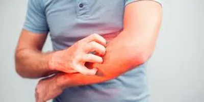 Illustration irritant - Image 2