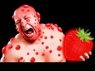 Illustration allergic - Image 1