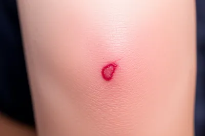 Illustration crease - Image 1