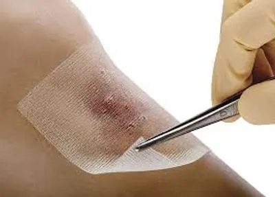 Illustration lint - Image 2