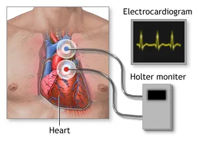 Illustration monitor - Image 2
