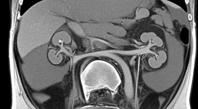 Illustration slices - Image 1